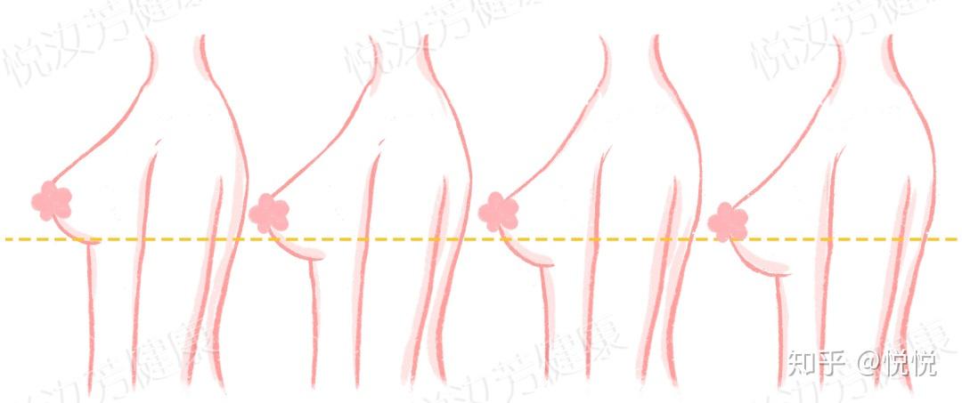 一般成熟女性的乳房根部距腋下12.5~17.5cm之间是平均胸位